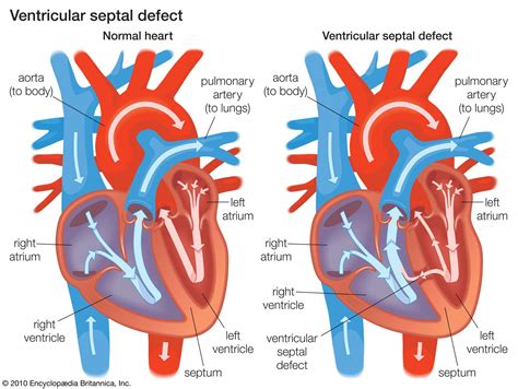 identify the left ventricle.